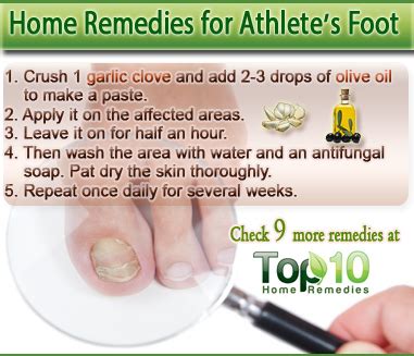 Home Remedies for Athlete’s Foot | Top 10 Home Remedies