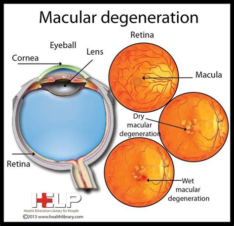 Pin on Ophthalmology