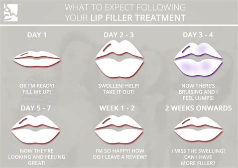 Is It Normal To Bruise A Lot After Lip Fillers | Sitelip.org