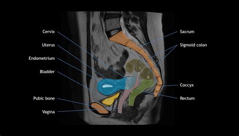 Uterus Anatomy Mri