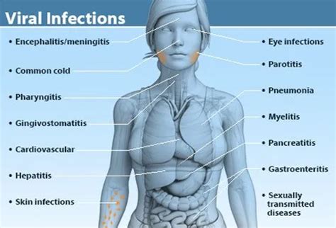 What's a Virus? Viral Infection Types, Symptoms, Treatment