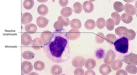 Pin on Hematology :)