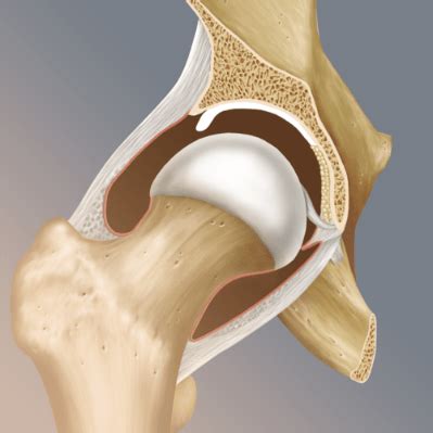 Hip Labral Tear X Ray