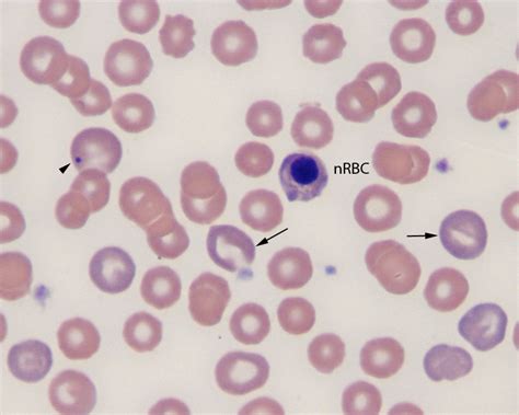 Regenerative anemia in a dog | eClinpath