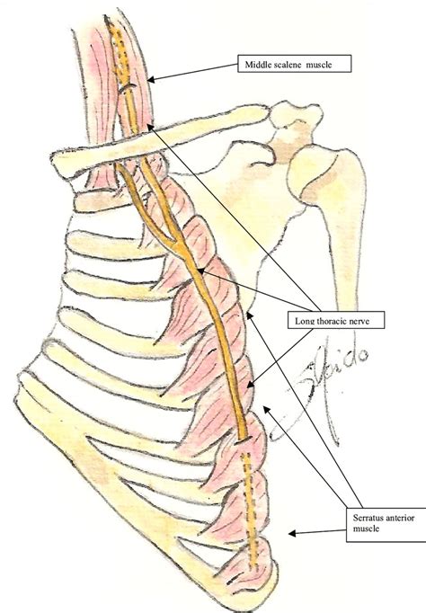 Long Thoracic Nerve Palsy