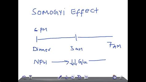 Medical Video Lecture: Somogyi effect Vs Dawn Phenomenon - YouTube