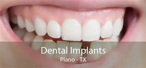 Dental Implants Plano, TX - Local Dental Implants