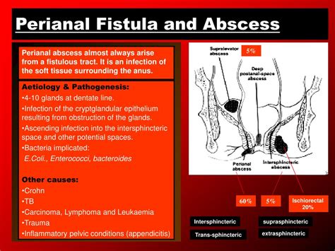 PPT - Benign Anorectal Conditions PowerPoint Presentation, free download - ID:214744