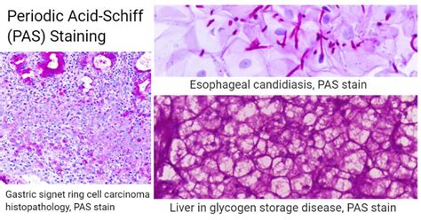 Periodic Acid-Schiff (PAS) Staining