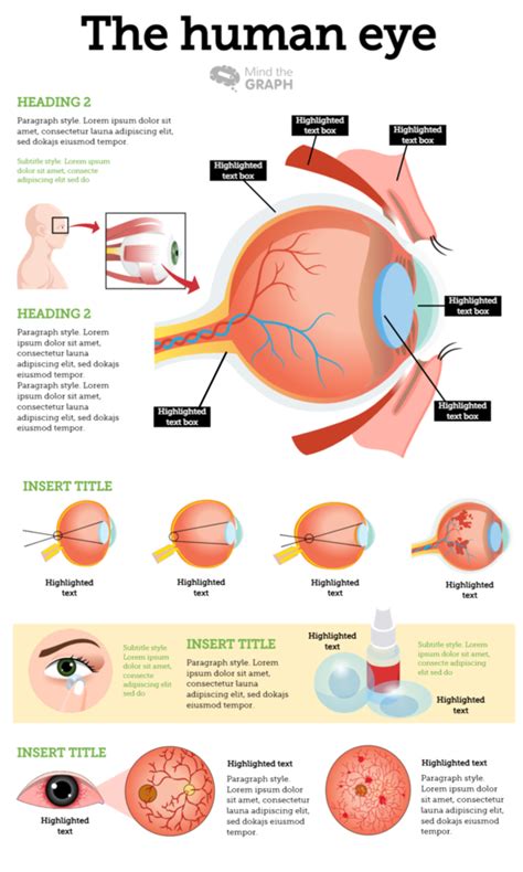 Infographic Template - Infographic Layout | Mind the Graph