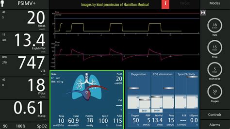 The Ventilator Screen- those numbers! - Critical Care Practitioner