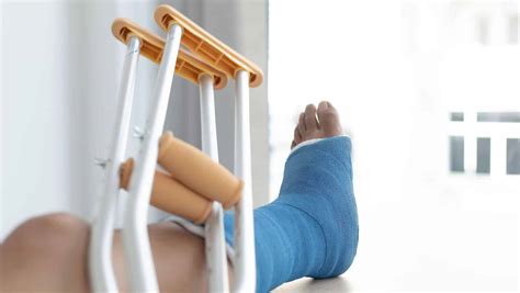 Dislocated Ankle: Symptoms, Causes & Treatment Explained