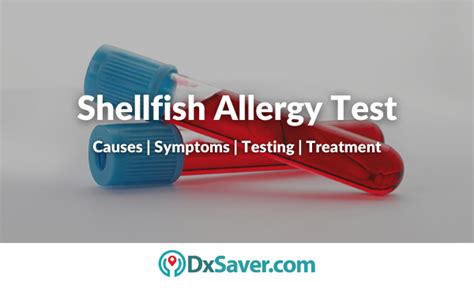 Shellfish Allergy Test – Causes, Symptoms and Treatment of Shellfish Allergy – DxSaver.com