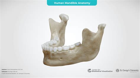 Human Mandible Anatomy - 3D model by The Center for BioMedical Visualization at SGU (@SGUMedArt ...