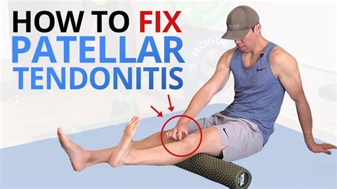 Why Common Patellar Tendonitis Rehab FAILS and 5 exercises that WORK ...