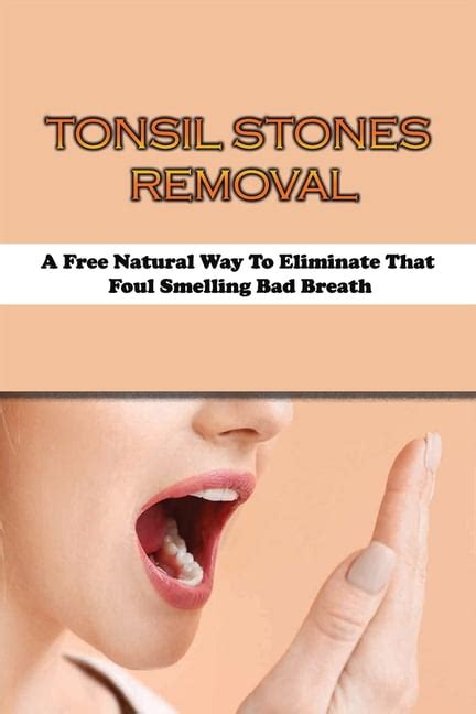 Tonsil Stones Removal: A Free Natural Way To Eliminate That Foul Smelling Bad Breath: How To ...