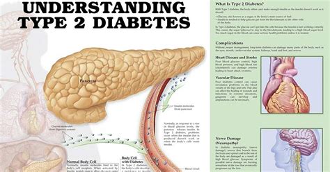 Diabetes a Powerful Risk Factor for Heart Problems in Young Women