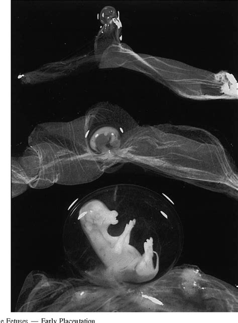 Figure 5 from The bovine placenta before and after birth: placental ...