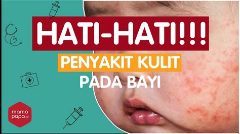 Kenali Penyakit Kulit Pada Bayi Merahputih - vrogue.co