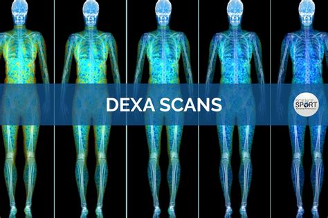 DEXA Scans - Science for Sport