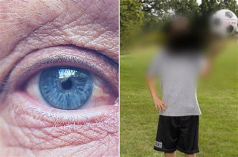 Macular Degeneration: Symptoms, Causes, and Treatment | College Review ...