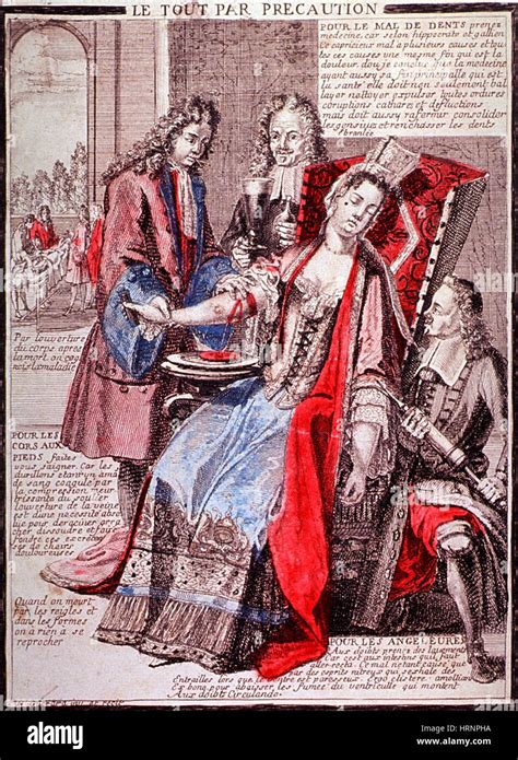 Bloodletting, 17th Century Stock Photo - Alamy