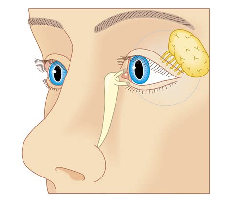 Nasolacrimal Ducts and Disorders