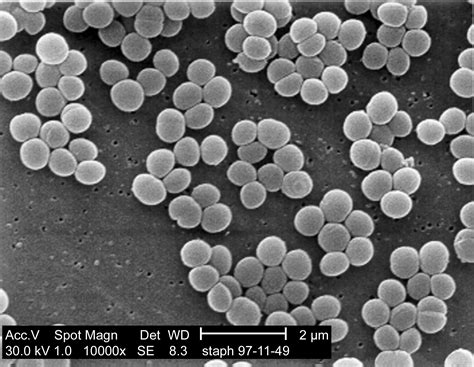 File:Staphylococcus aureus 01.jpg - Wikipedia