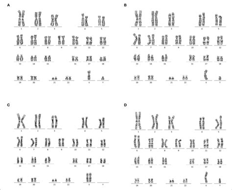 | Karyotype analysis. (A) Normal karyotype analysis of amniotic fluid ...