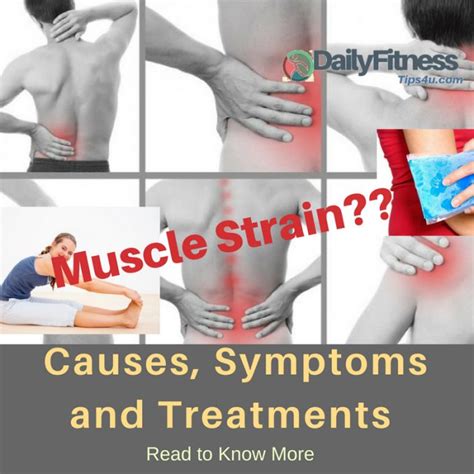 Muscle Strain : Causes, Picture, Symptoms And Treatment