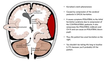 “I’ll give You some Board Review.” -David Robinson, MD PGY4 - ppt download