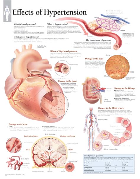 Effects of Hypertension | Scientific Publishing