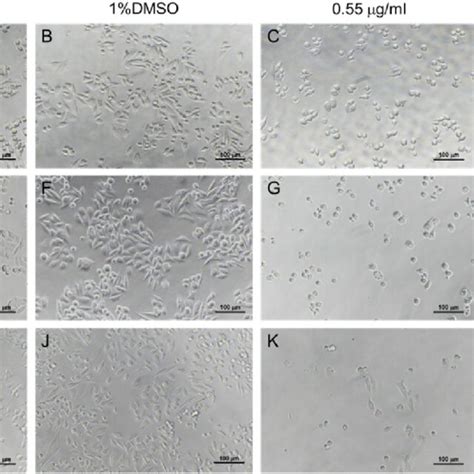 Effects of GHR on SW480 cell morphology. SW480 cells were treated with ...