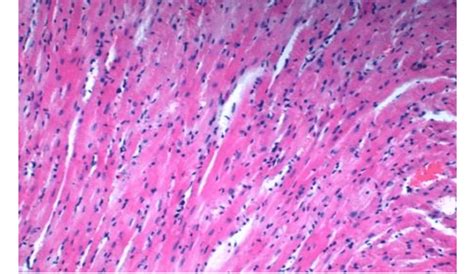 Skeletal muscle tissue of an animal receiving pantocrine. Stained by... | Download Scientific ...