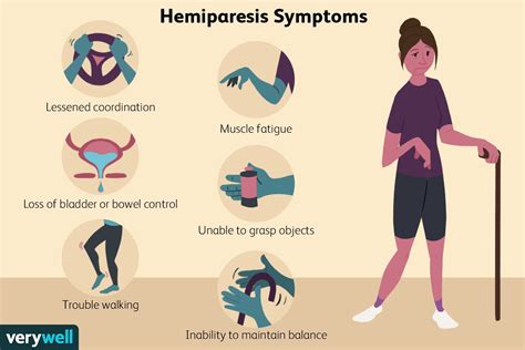 Hemiparesia - Medicina Básica