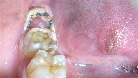 Restorative Dentistry | The Dental Loop