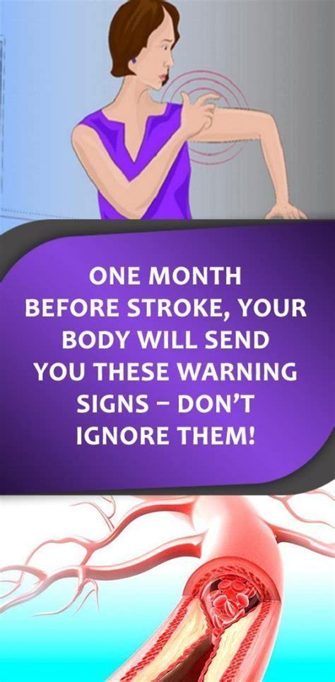 ONE MONTH BEFORE STROKE, YOUR BODY WILL SEND YOU THESE WARNING SIGNS – DON’T IGNORE THEM ...