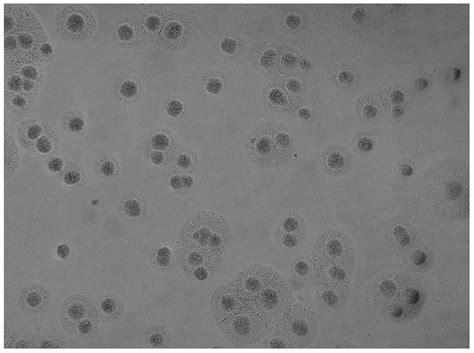 Human mycoplasma pneumoniae culture medium and diagnosis kit thereof ...