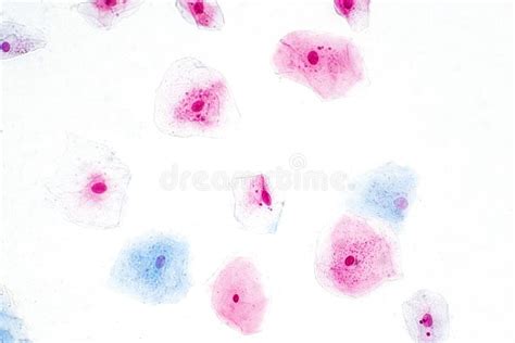 Squamous Epithelial Cells Under Microscope View Stock Image - Image of cervix, cytology: 114795723