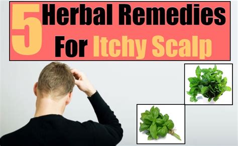 5 Herbal Remedies For Itchy Scalp – Natural Home Remedies & Supplements