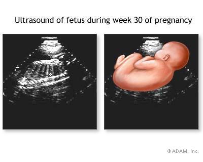 The New York Times > Health > Image > 30 Week Ultrasound