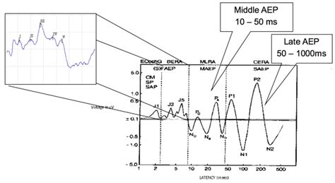 Brainstem Audiotory Evoked Potentials In Adhd