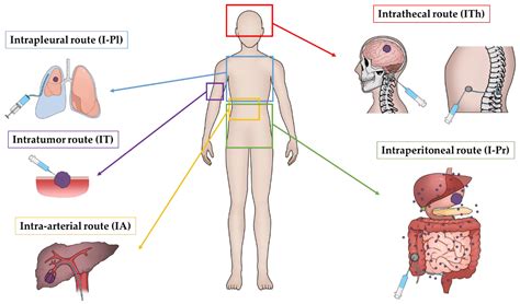 Intrathecal Chemo Administration