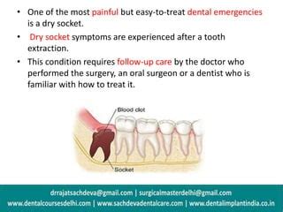 Dry Socket Treatment