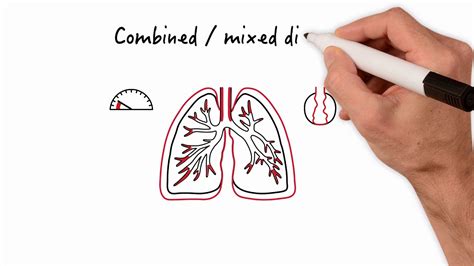 Deciphering Abnormal Pulmonary Function Tests (PFT): Diagnostic Insights - YouTube