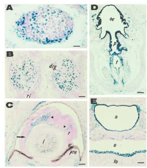 Analysis of lacZ expression patterns in various sites of W lacZ /W lacZ ...