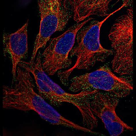 CIL:41684, Homo sapiens, osteocarcinoma. CIL. Dataset