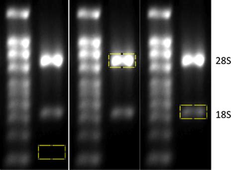 SYBR Green qPCR with Standard Curve Protocol