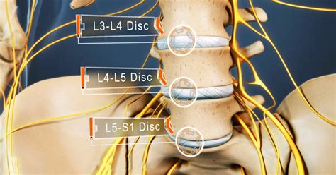 L4 L5 S1 Segmento vertebral | Dr Alberto Marqués