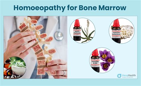 Hypocellular Bone Marrow - Causes, Symptoms & Treatment